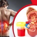 প্রস্রাবে এসব সমস্যা দেখলেই বুঝবেন কিডনি ভালো নেই